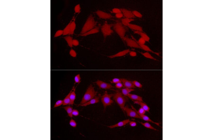 Immunofluorescence - Anti-CDK2 Antibody (A91675) - Antibodies.com