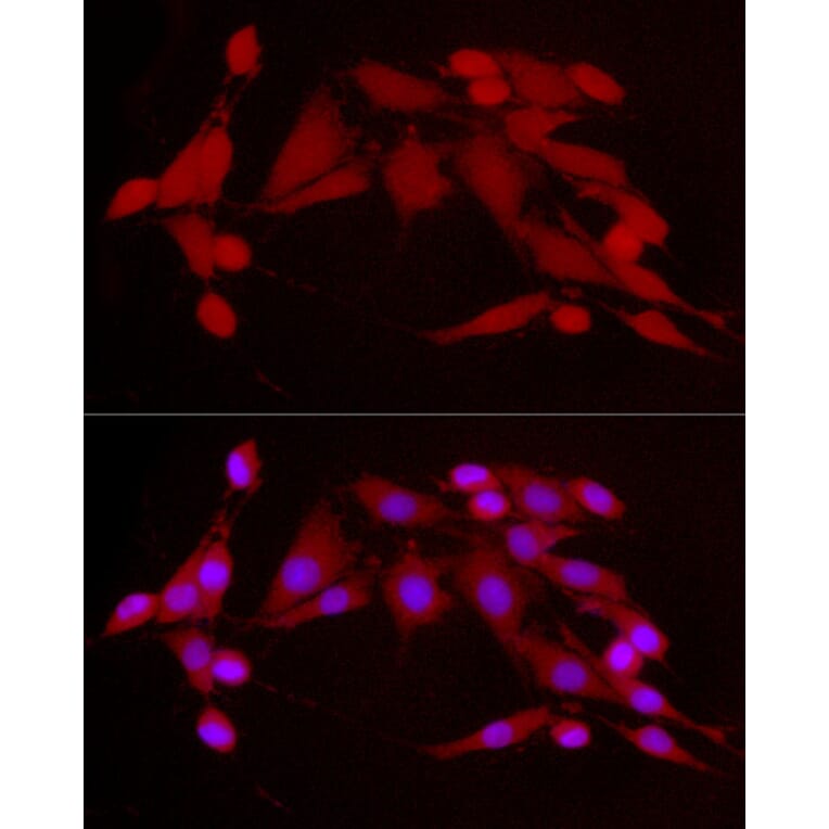 Immunofluorescence - Anti-CDK2 Antibody (A91675) - Antibodies.com
