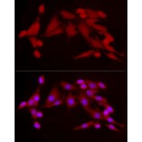 Immunofluorescence - Anti-CDK2 Antibody (A91675) - Antibodies.com