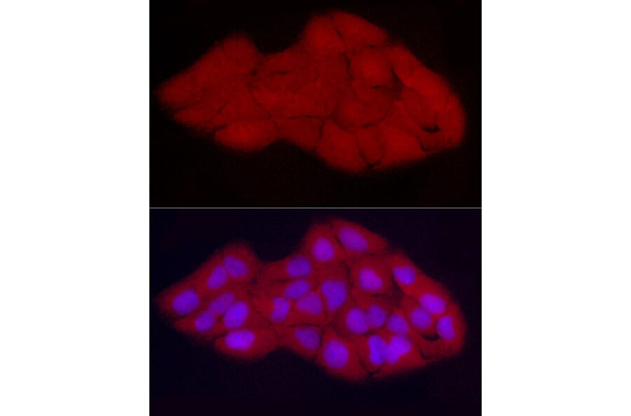 Immunofluorescence - Anti-CDK2 Antibody (A91675) - Antibodies.com