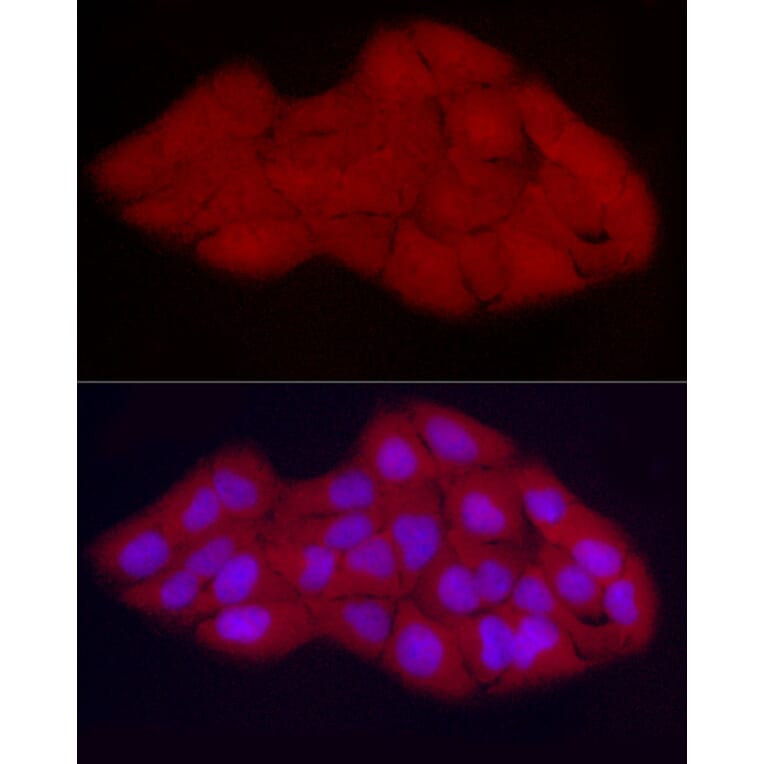 Immunofluorescence - Anti-CDK2 Antibody (A91675) - Antibodies.com