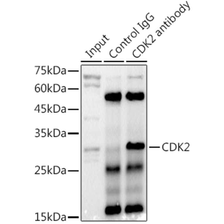 Western Blot - Anti-CDK2 Antibody (A91675) - Antibodies.com