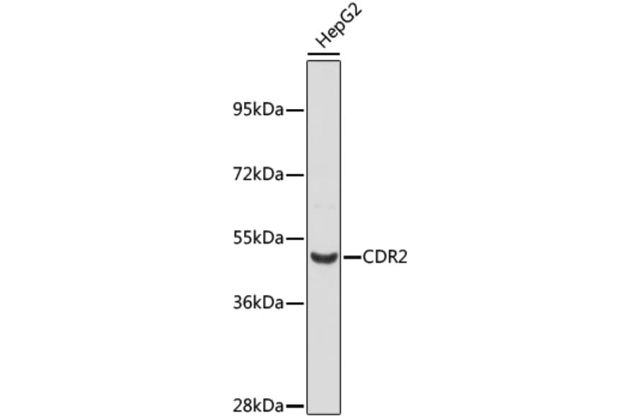 Western Blot - Anti-CDR2 Antibody (A12735) - Antibodies.com
