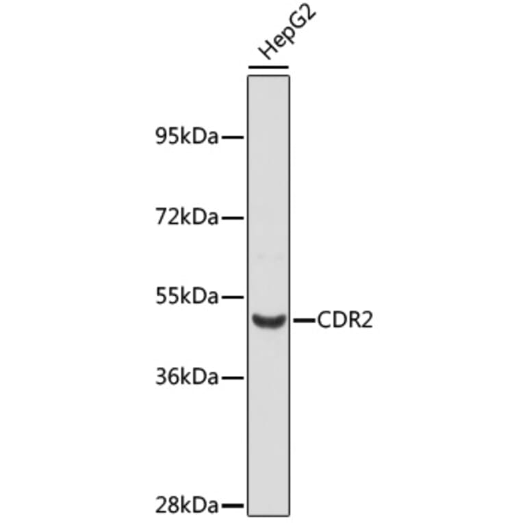 Western Blot - Anti-CDR2 Antibody (A12735) - Antibodies.com