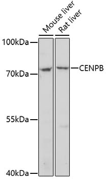 Western blot analysis of extracts of various cell lines, using Anti-CENPB Antibody (A16817) at 1:1,000 dilution.
Secondary antibody: Goat Anti-Rabbit IgG (H+L) (HRP) (AS014) at 1:10,000 dilution.
Lysates / proteins: 25µg per lane.
Blocking buffer: 3% non-fat dry milk in TBST.
Detection: ECL Basic Kit (RM00020).
Exposure time: 5min.
