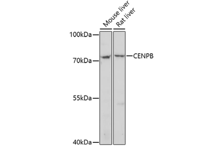 Western Blot - Anti-CENPB Antibody (A91677) - Antibodies.com