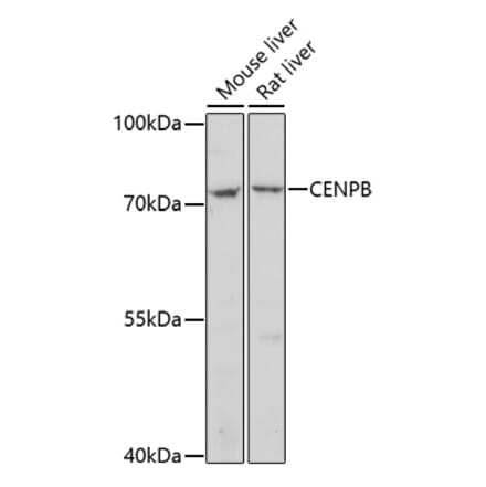 Western Blot - Anti-CENPB Antibody (A91677) - Antibodies.com