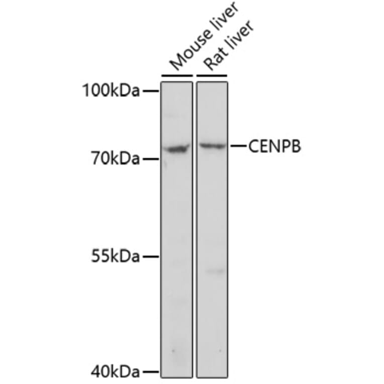 Western Blot - Anti-CENPB Antibody (A91677) - Antibodies.com