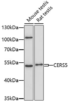 Western blot analysis of extracts of various cell lines, using Anti-CERS5 Antibody (A17239) at 1:1,000 dilution.
Secondary antibody: Goat Anti-Rabbit IgG (H+L) (HRP) (AS014) at 1:10,000 dilution.
Lysates / proteins: 25µg per lane.
Blocking buffer: 3% non-fat dry milk in TBST.
Detection: ECL Basic Kit (RM00020).
Exposure time: 90s.