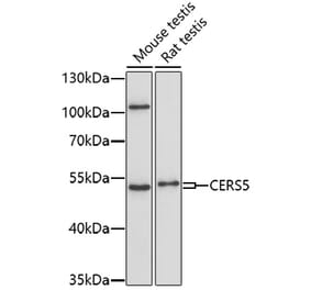 Western Blot - Anti-Lass5 Antibody (A91678) - Antibodies.com