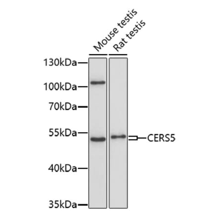 Western Blot - Anti-Lass5 Antibody (A91678) - Antibodies.com