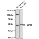 Western Blot - Anti-Lass5 Antibody (A91678) - Antibodies.com