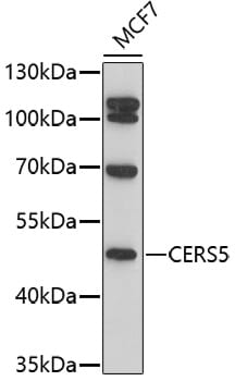 Western blot analysis of extracts of MCF7 cells, using Anti-CERS5 Antibody (A17240) at 1:1,000 dilution.
Secondary antibody: Goat Anti-Rabbit IgG (H+L) (HRP) (AS014) at 1:10,000 dilution.
Lysates / proteins: 25µg per lane.
Blocking buffer: 3% non-fat dry milk in TBST.
Detection: ECL Basic Kit (RM00020).
Exposure time: 90s.