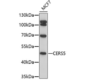 Western Blot - Anti-Lass5 Antibody (A91679) - Antibodies.com
