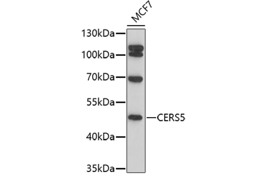 Western Blot - Anti-Lass5 Antibody (A91679) - Antibodies.com