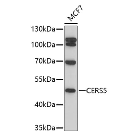 Western Blot - Anti-Lass5 Antibody (A91679) - Antibodies.com