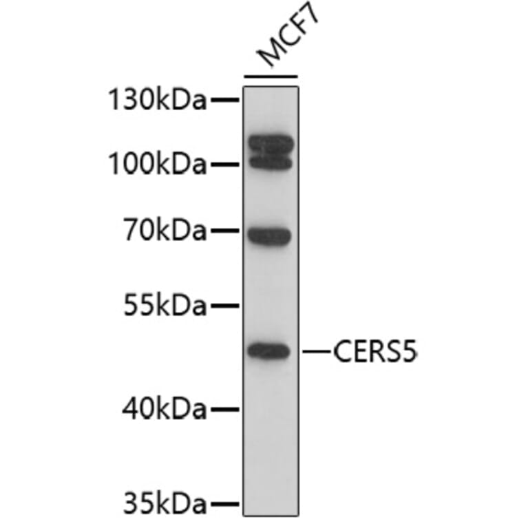 Western Blot - Anti-Lass5 Antibody (A91679) - Antibodies.com
