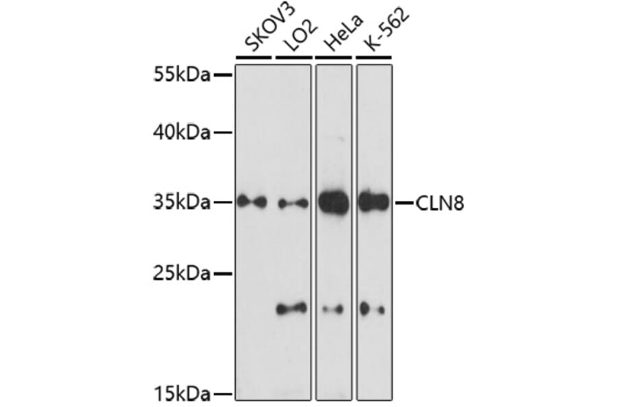 Western Blot - Anti-CLN8 peptide Antibody (A91681) - Antibodies.com