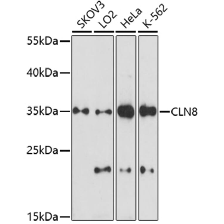 Western Blot - Anti-CLN8 peptide Antibody (A91681) - Antibodies.com