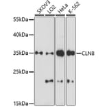 Western Blot - Anti-CLN8 peptide Antibody (A91681) - Antibodies.com