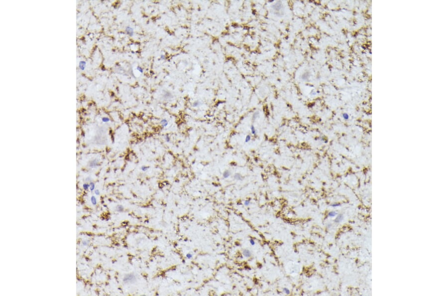 Immunohistochemistry - Anti-CLN8 peptide Antibody (A91681) - Antibodies.com