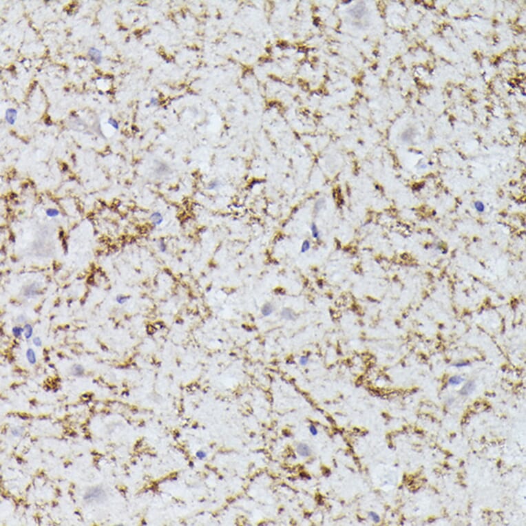 Immunohistochemistry - Anti-CLN8 peptide Antibody (A91681) - Antibodies.com