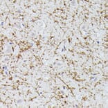 Immunohistochemistry - Anti-CLN8 peptide Antibody (A91681) - Antibodies.com