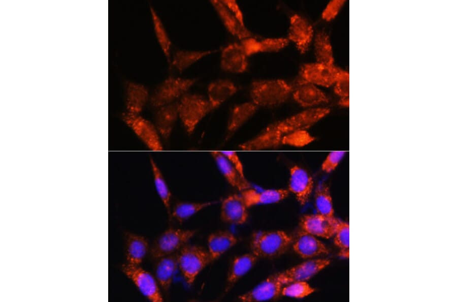 Immunofluorescence - Anti-Cytochrome C Oxidase subunit VIc/COX6C Antibody (A91683) - Antibodies.com
