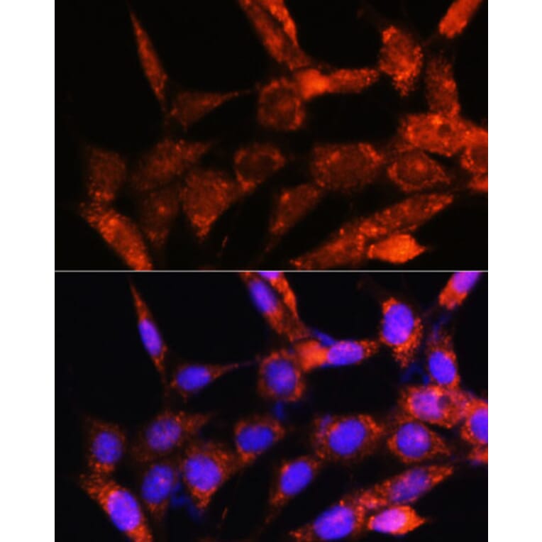 Immunofluorescence - Anti-Cytochrome C Oxidase subunit VIc/COX6C Antibody (A91683) - Antibodies.com