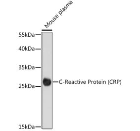Western Blot - Anti-C Reactive Protein Antibody (A91684) - Antibodies.com