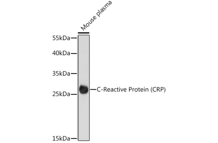 Western Blot - Anti-C Reactive Protein Antibody (A91684) - Antibodies.com