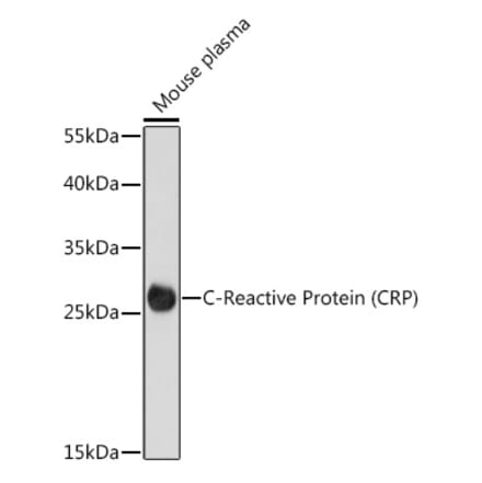 Western Blot - Anti-C Reactive Protein Antibody (A91684) - Antibodies.com