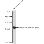 Western Blot - Anti-C Reactive Protein Antibody (A91684) - Antibodies.com