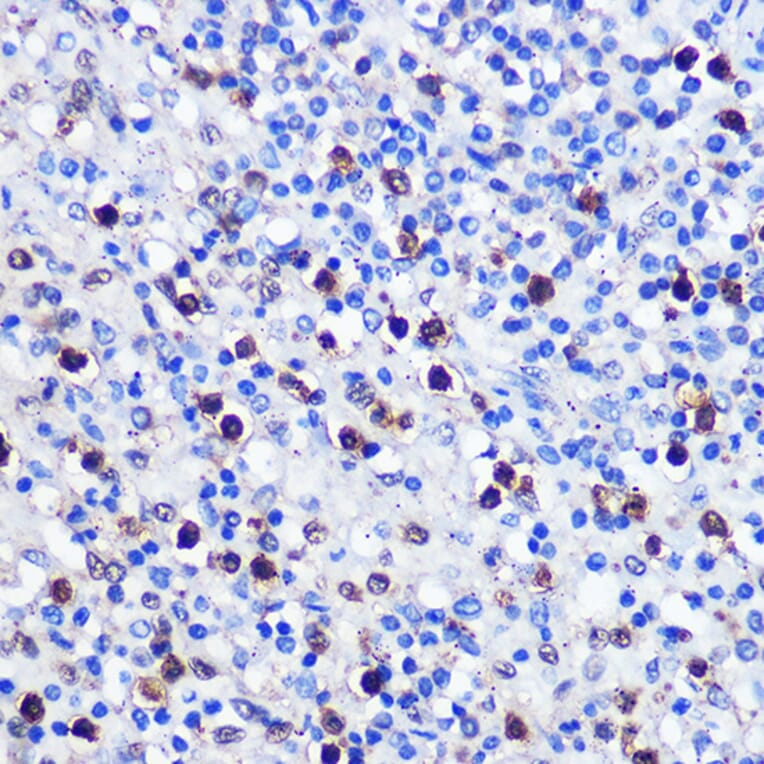 Immunohistochemistry - Anti-Dnmt1 Antibody (A91686) - Antibodies.com