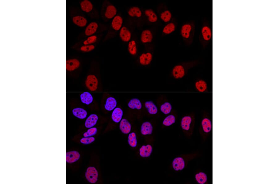Immunofluorescence - Anti-Dnmt1 Antibody (A91686) - Antibodies.com