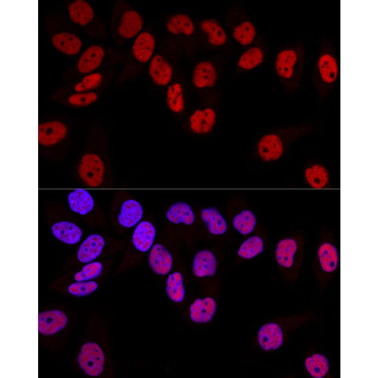 Immunofluorescence - Anti-Dnmt1 Antibody (A91686) - Antibodies.com