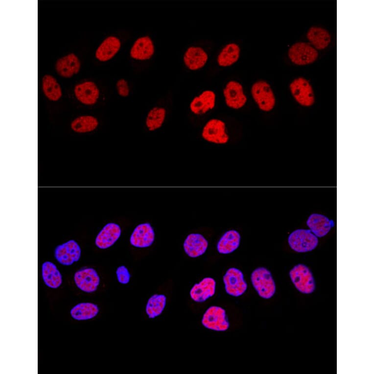 Immunofluorescence - Anti-Dnmt1 Antibody (A91686) - Antibodies.com