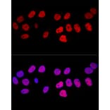 Immunofluorescence - Anti-Dnmt1 Antibody (A91686) - Antibodies.com