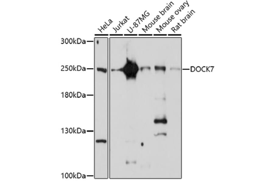 Western Blot - Anti-DOCK7 Antibody (A91687) - Antibodies.com
