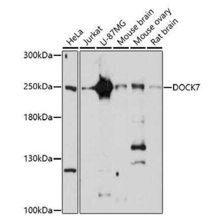 Western Blot - Anti-DOCK7 Antibody (A91687) - Antibodies.com