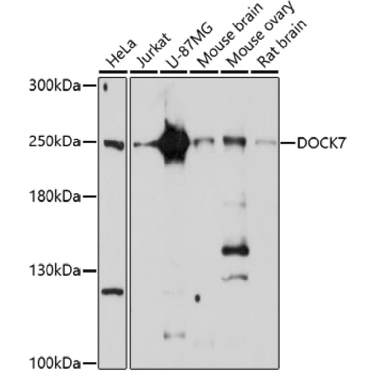 Western Blot - Anti-DOCK7 Antibody (A91687) - Antibodies.com