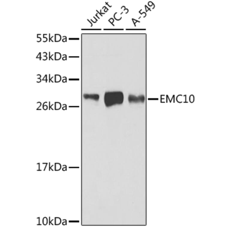 Western Blot - Anti-EMC10 Antibody (A16712) - Antibodies.com