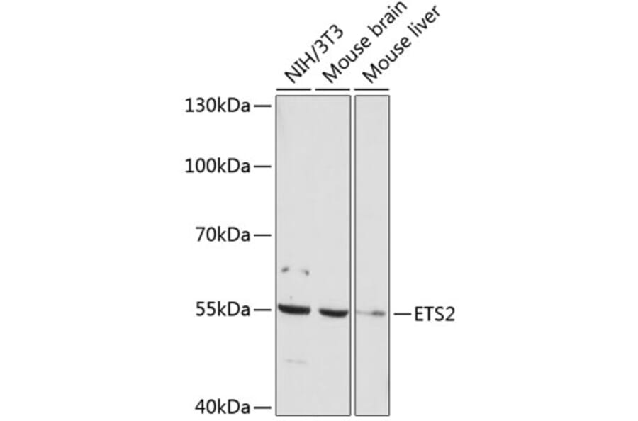 Western Blot - Anti-ETS2 Antibody (A91690) - Antibodies.com