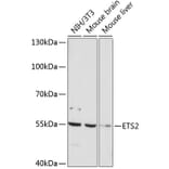 Western Blot - Anti-ETS2 Antibody (A91690) - Antibodies.com
