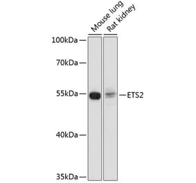 Western Blot - Anti-ETS2 Antibody (A91691) - Antibodies.com