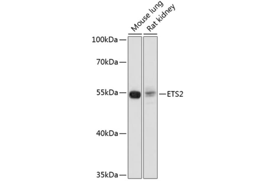 Western Blot - Anti-ETS2 Antibody (A91691) - Antibodies.com