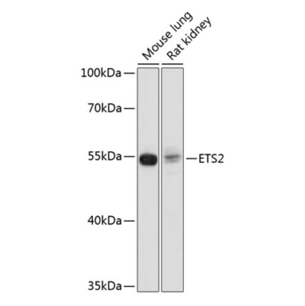 Western Blot - Anti-ETS2 Antibody (A91691) - Antibodies.com