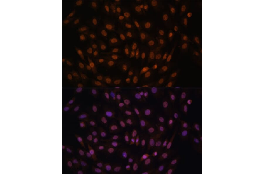 Immunofluorescence - Anti-FCF1 Antibody (A91692) - Antibodies.com