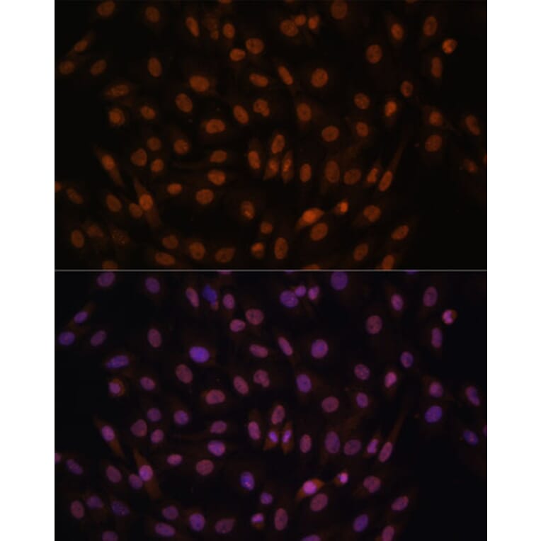 Immunofluorescence - Anti-FCF1 Antibody (A91692) - Antibodies.com
