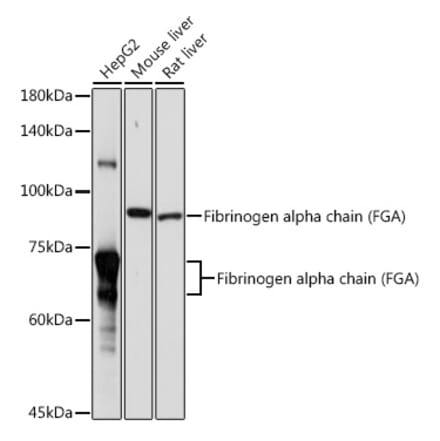 Western Blot - Anti-Fibrinogen Alpha Chain Antibody (A91694) - Antibodies.com
